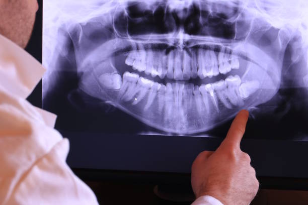 Best Emergency Dental Services for Seniors in Front Royal, VA